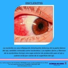 CLINICA DE OJOS OFTALMIC LASER