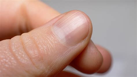 11 Tips For Getting Rid Of Unsightly Fingernail Ridges