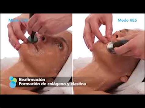 Indiba Deep Care Ns Radiofrecuencia Sevilla Youtube