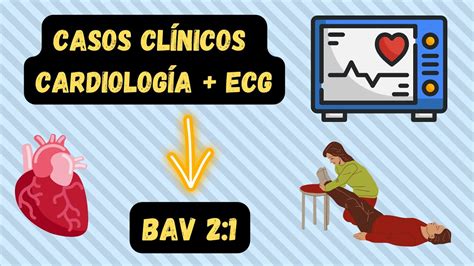 SÍNCOPE ECG ANALIZANDO CASOS CLÍNICOS YouTube