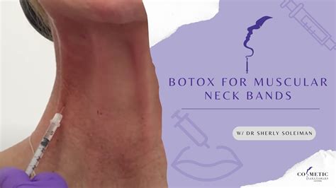 Botox For Muscular Neck Bands Youtube