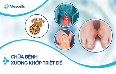 Chữa bệnh xương khớp triệt để Kết hợp phương pháp y học cổ truyền và