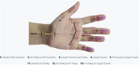 Extensor Tendon And Flexor Tendon Injuries Teton Hand Surgery