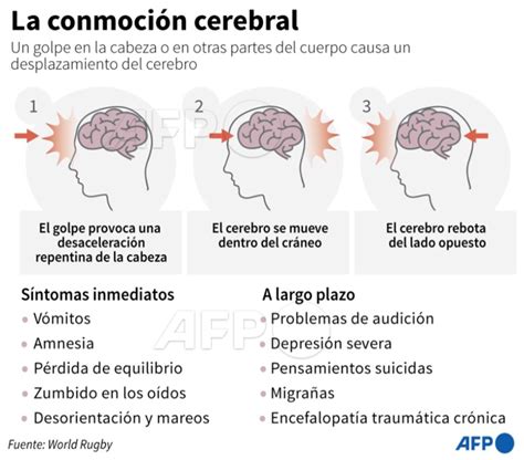 Afp La Conmoci N Cerebral Una Lesi N Frecuente En El Deporte