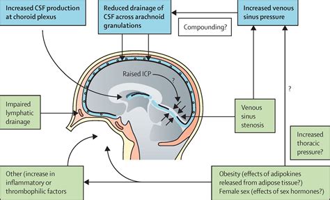 Intracranial Hypertension Symptoms