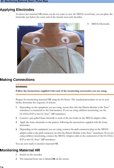 Philips Medical Systems North America OBRWRPBV1 Patient Monitoring User