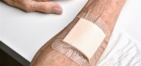 role  drainage dressings  wound care  fast recovery