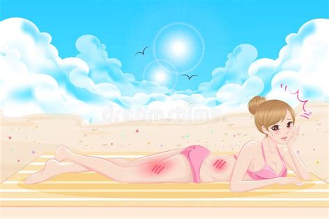 Sunburn Stock Illustrations 3 095 Sunburn Stock Illustrations