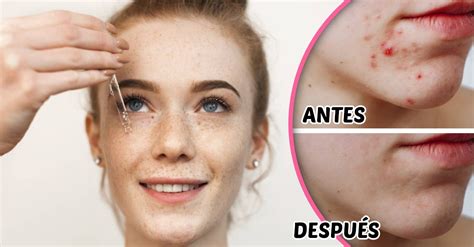 Conoce Todo Acerca Del Retinol Y Sus Efectos En Tu Piel