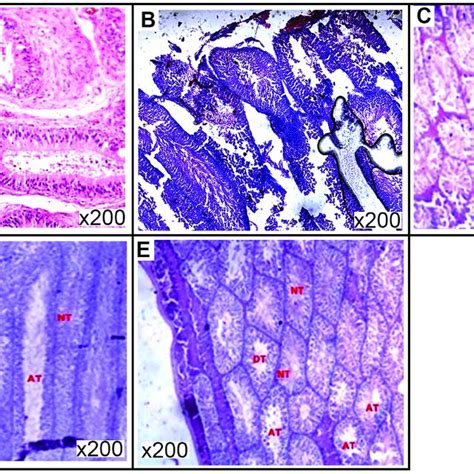 Representative Photomicrographs Of Histological Assessment Of Testes Of