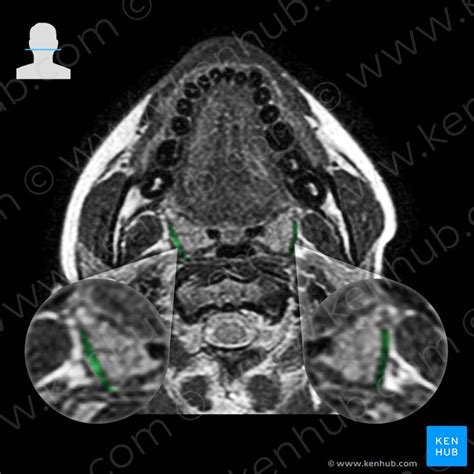 Muscles Of The Pharynx Anatomy Origins And Insertions Kenhub