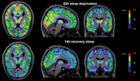 How The Brain Reacts To Sleep Deprivation Neuroscience News