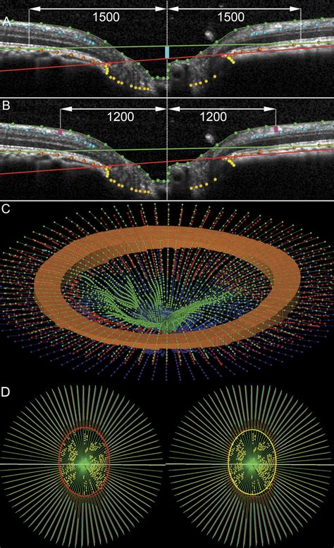 Parameterization Of Spectral Domain Optical Coherence Tomography