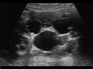 Urinary Tract and male reproductive system | 2.1 Kidney and ureter ...