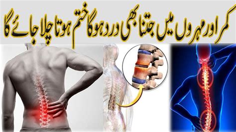 Kamar Dard Ka Fori Ilaj Back Pain Treatment Neurosurgery