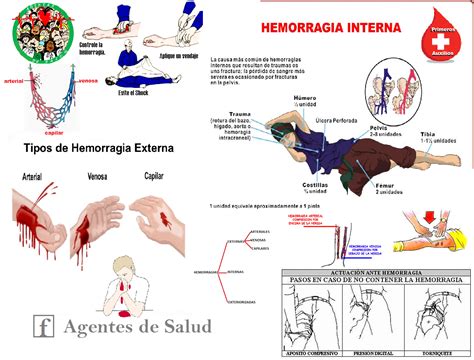 Agentes De Salud Hemorragias