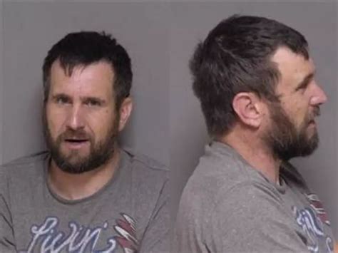 Man Charged For Biting Minnesota Police Officer