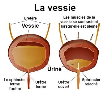 R Tention Urinaire