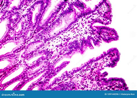 Cross Section Of Stomach Light Micrograph Showing Stomach Epithelium