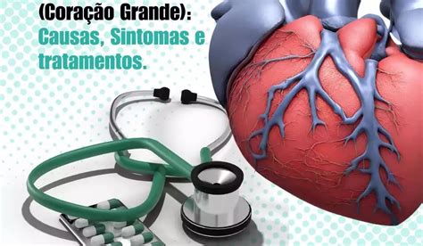 Coração Grande O Que É - Cardiomegalia (Coração Grande): Causas, Sintomas e tratamentos.