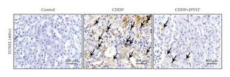 Jpyst Ameliorates Cddp Induced Renal Apoptosis Levels A Apoptosis Of