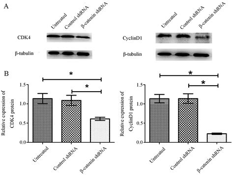 β Catenin Knockdown Inhibits Pituitary Adenoma Cell Proliferation And