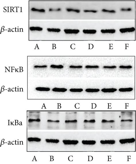 Effect Of Mbhd On The Expression Of Sirt1 Iκbα And Nf κb P65 Protein