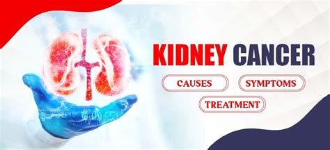 Kidney Cancer: Causes, Symptoms and Treatment - amandeephospital