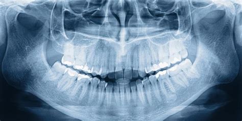 Dental Imaging: Types and Their Uses - Flip Collective