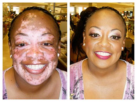 Corrective Makeup Before And After Makeup Vidalondon