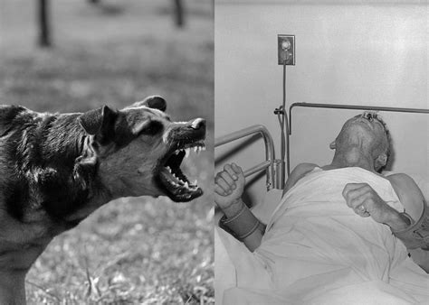 Rabies: Penyebab, Gejala, Pengobatan dan Pencegahan