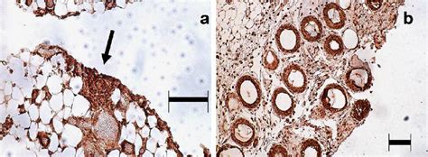 Immunostaining Of Native And Activated Omentum For The Chemokine