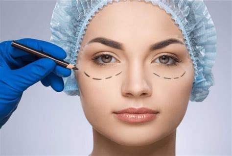 Saiba Tudo Sobre A Blefaroplastia Blefaroplastia Niterói Guia Saúde