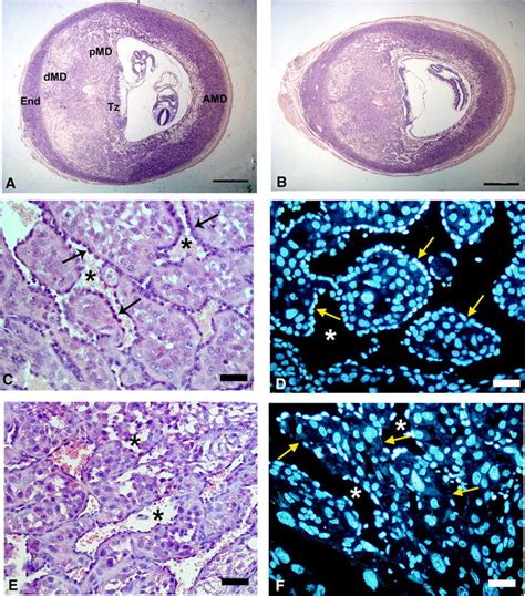 Histological effects on decidual tissues after perigestational alcohol... | Download Scientific ...