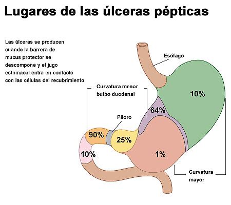 Lugares De Las Lceras P Pticas Icarito