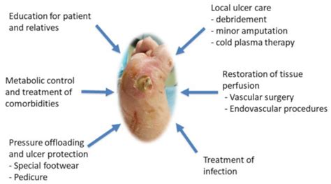 Biomedicines Free Full Text Stem Cell Based Therapy A Promising Treatment For Diabetic Foot