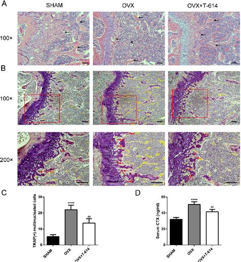 Figure 2 From Iguratimod Suppresses Osteoclastogenesis And Prevents