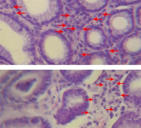 Plasma cells were examined through light microscope using x40 objective... | Download Scientific ...