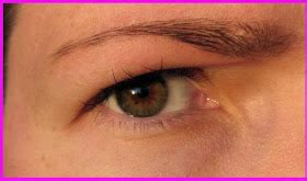 Eyebrow Threading: Itchy eyebrows - symptoms & treatments