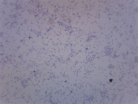 Eisco Clostridium Botulinum, Gram Positive Clostridium Botulinum:Education | Fisher Scientific