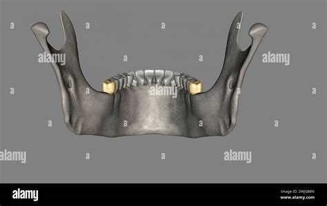 El tercer molar mandibular también se conoce como la ilustración 3d de