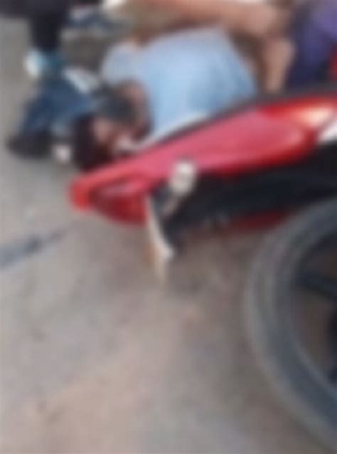 Motociclista Tem Perna Dilacerada Ao Bater Na Traseira De Trator