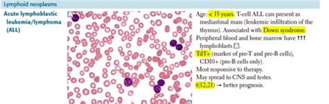 Major Types Of Lymphoid Leukemias And Non Hodgkin Lymphomas Flashcards