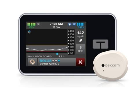 Tandem integrates Dexcom G7 into automated insulin pump