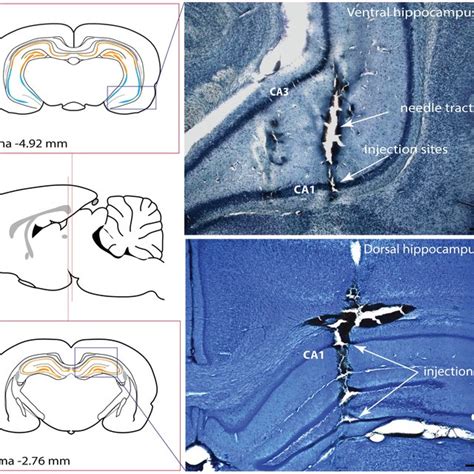 Activation Of Neurones In The Ventral Hippocampus Suppress The Normal