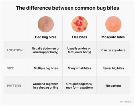 Flea Bites On Human Legs