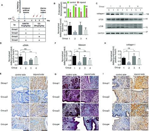 Autophagy Reversed The Effects Of The SHH Pathway On Murine Endometrial