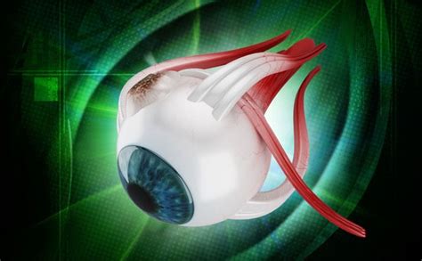 Scheelzien Bijziendheid Keratoconus Endotheliale Transplantatie