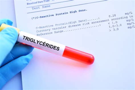 Qu est ce qui provoque un taux de triglycérides élevé