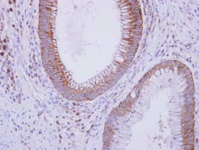 Complement Component C9 Antibody NBP2 15951 Novus Biologicals